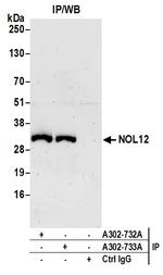 NOL12 Antibody in Immunoprecipitation (IP)