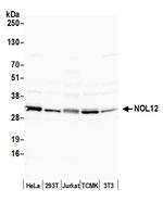 NOL12 Antibody in Western Blot (WB)
