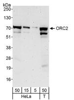 ORC2 Antibody in Western Blot (WB)