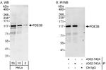 PDE3B Polyclonal Antibody