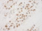 MSK1 Polyclonal Antibody