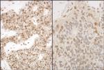 PSMA5 Polyclonal Antibody