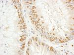 GTF2E1/TFIIE-alpha Antibody in Immunohistochemistry (Paraffin) (IHC (P))