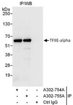 GTF2E1/TFIIE-alpha Antibody in Immunoprecipitation (IP)