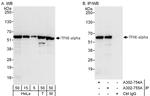 GTF2E1/TFIIE-alpha Antibody in Western Blot (WB)
