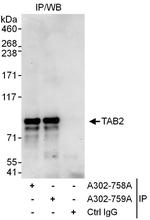 TAB2 Polyclonal Antibody