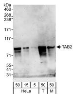 TAB2 Polyclonal Antibody
