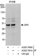 AP4 Antibody in Immunoprecipitation (IP)