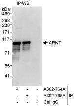 ARNT Antibody in Immunoprecipitation (IP)