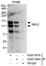 MKL2 Polyclonal Antibody