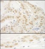 MKL2 Polyclonal Antibody