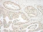 NFAT3 Polyclonal Antibody