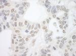 PRP6 Antibody in Immunohistochemistry (Paraffin) (IHC (P))