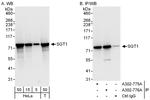 GCR2/SGT1 Polyclonal Antibody