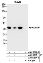 Arpc1b Antibody in Immunoprecipitation (IP)