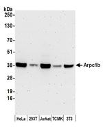 Arpc1b Antibody in Western Blot (WB)