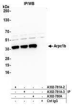 Arpc1b Antibody in Immunoprecipitation (IP)