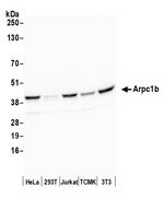 Arpc1b Polyclonal Antibody