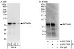 BEGAIN Polyclonal Antibody