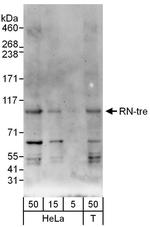 RN-tre Polyclonal Antibody