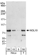 NOL10 Antibody in Western Blot (WB)