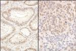 PQBP1 Polyclonal Antibody