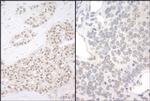 PQBP1 Polyclonal Antibody