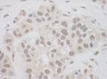 SUPT7L Antibody in Immunohistochemistry (Paraffin) (IHC (P))