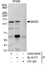 SMG5 Antibody in Immunoprecipitation (IP)