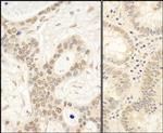 FAF1 Polyclonal Antibody