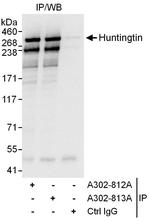 Huntingtin Antibody in Immunoprecipitation (IP)