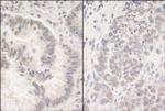 PUF60 Polyclonal Antibody