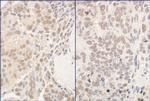 PUF60 Polyclonal Antibody