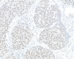 HJURP Polyclonal Antibody
