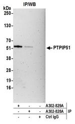 PTPIP51 Antibody in Immunoprecipitation (IP)