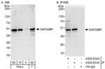 SAP30BP Polyclonal Antibody