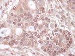 THOC1 Antibody in Immunohistochemistry (Paraffin) (IHC (P))