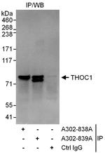 THOC1 Antibody in Immunoprecipitation (IP)