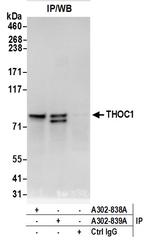 THOC1 Antibody in Immunoprecipitation (IP)
