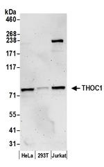 THOC1 Antibody in Western Blot (WB)