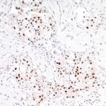 TRAF4 Polyclonal Antibody