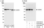 HSP60 Antibody in Western Blot (WB)