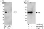 CAR Antibody in Western Blot (WB)