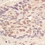 L3MBTL3 Antibody in Immunohistochemistry (Paraffin) (IHC (P))