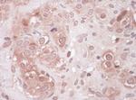 Sequestosome-1 Antibody in Immunohistochemistry (Paraffin) (IHC (P))