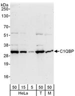 C1QBP Antibody in Western Blot (WB)
