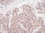 MAX Polyclonal Antibody