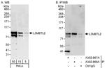 L3MBTL2 Polyclonal Antibody