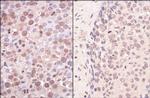 SmcHD1 Polyclonal Antibody