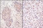 SmcHD1 Polyclonal Antibody
